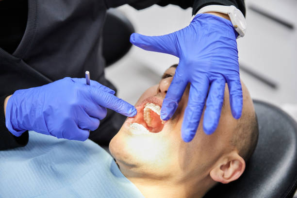 Best Dental Abscess Treatment in Triangle, VA